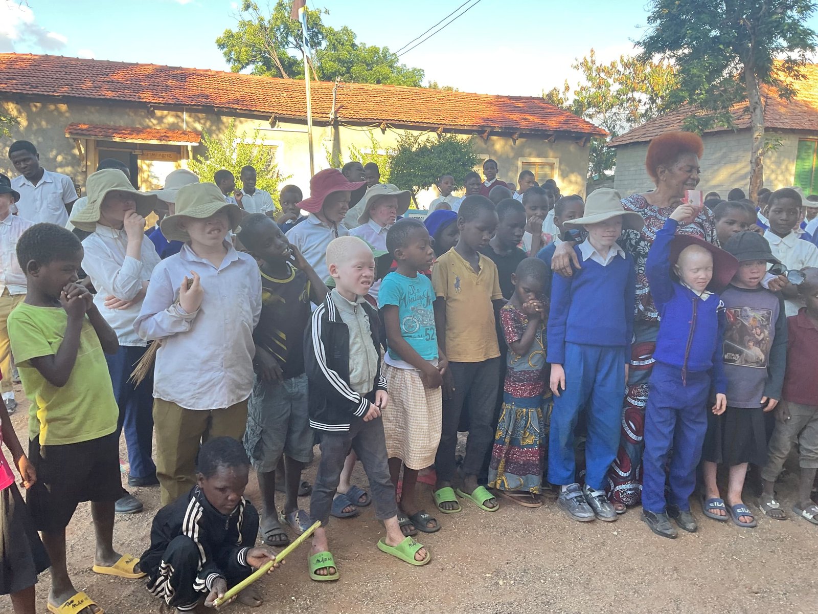 School outreach visit for children with albinism